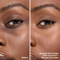 Before and After Bright Eyes Set